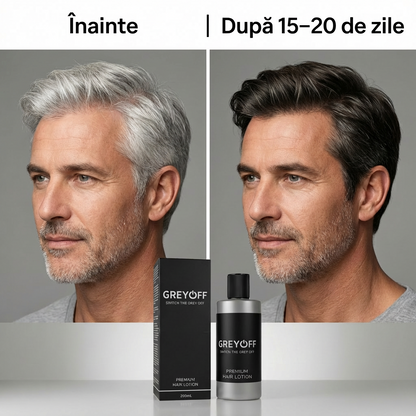 GreyOFF – Kevesebb ősz haj. Festés nélkül. Természetes módon.